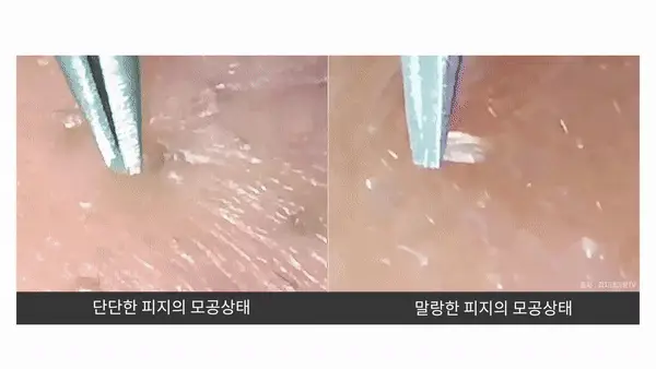 [피지캐는크림] 라돌프 퓨어파지 크림 알엑스 80g 상세페이지 8